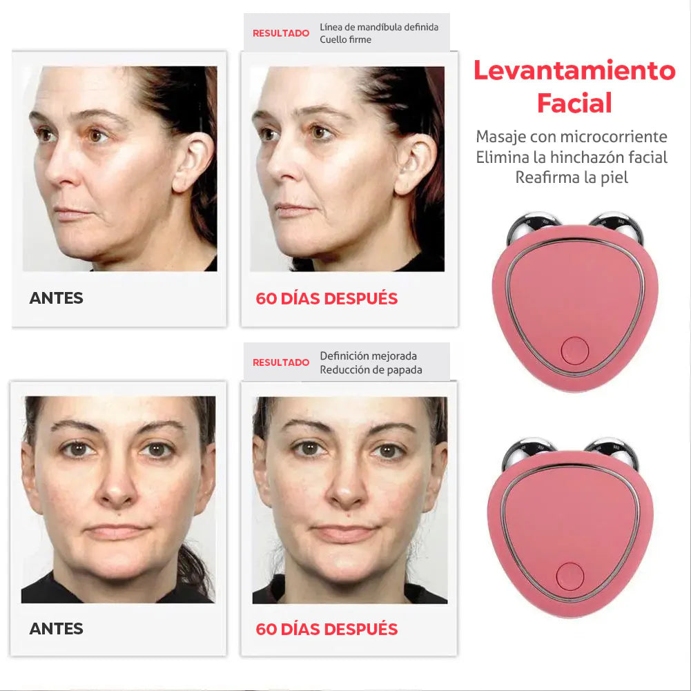 Masajeador Facial con Microcorriente SkinBeauty
