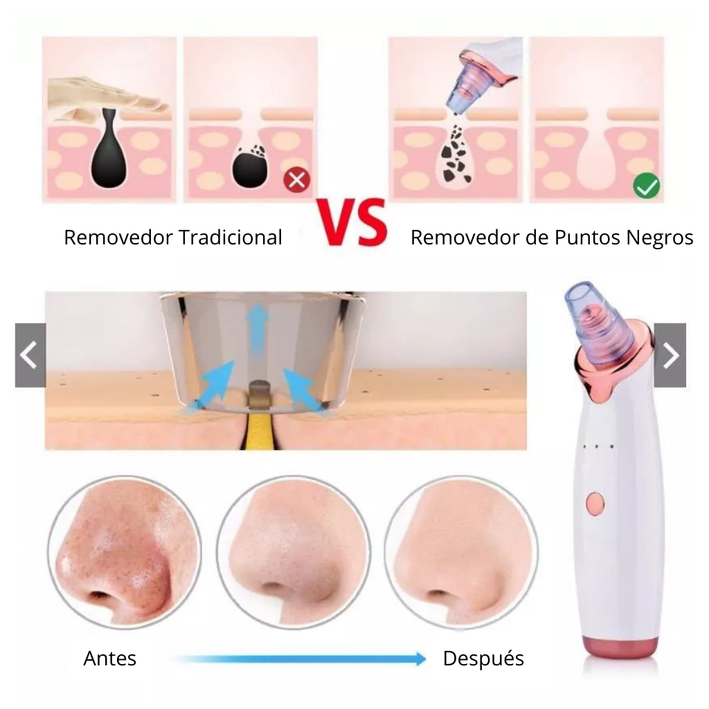 Removedor Puntos Negros