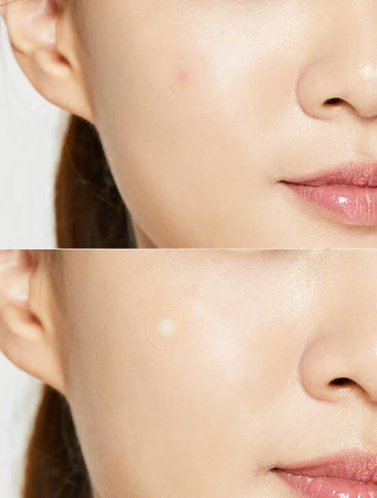 Parches Acné COSRX Pimple Master Patch