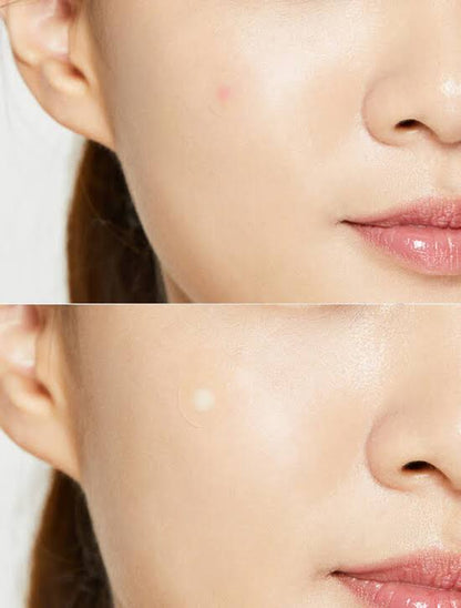 Parches Acné COSRX Pimple Master Patch