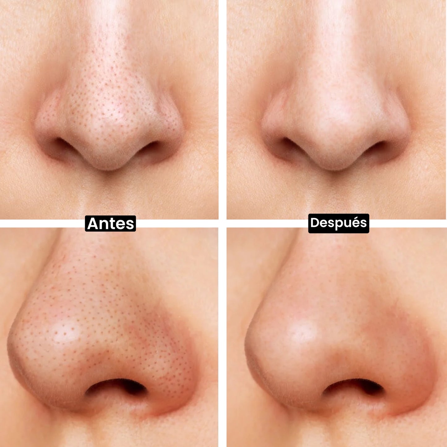 Pack Limpieza Facial (Sauna Facial + Removedor de Puntos Negros)